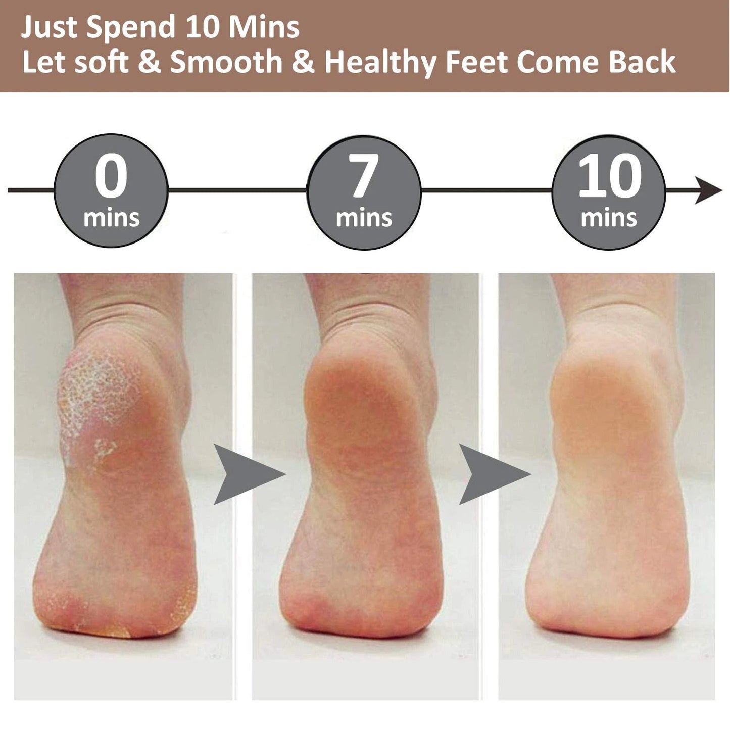 Electric Pedi Callus Remover