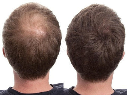 Caboki Hair Building Fibers